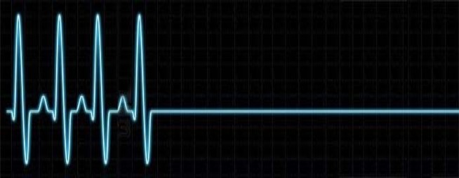 electrocardiogramme-plat1.jpg