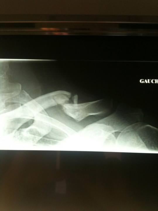 post-7615-0-46446100-1327075061_thumb.jp